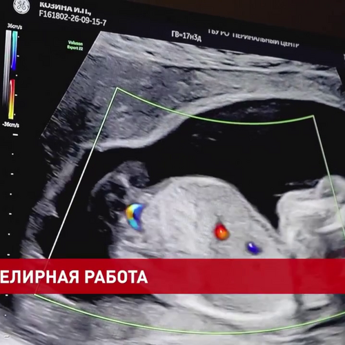 Внутриутробное переливание крови